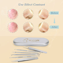 Load image into Gallery viewer, Blackhead Remover 6PCS Blackhead Removal Tools Spot Remover Comedone Extractor Tweezers Pimple Spot Popper Removal Tool