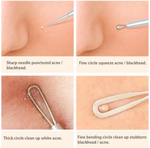Load image into Gallery viewer, Blackhead Remover Tool Kit 5Pcs Spot Remover Tool- Acne Pimple Comedone Extractor - Pimple Popper for Facial Care Skin Protect with Silver Metal Case (5PCS)