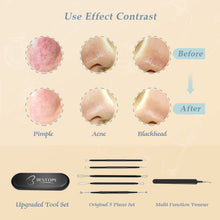 Load image into Gallery viewer, Blackhead Removal Tools 6PCS