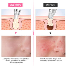 Load image into Gallery viewer, Mitesserentferner Vakuum Porensauger Multifunktions Mitessersauger Heizmodus 3 Modi BESTOPE Pro mit 6 Ersatzsonden und 4 Komedonenquetscher Set